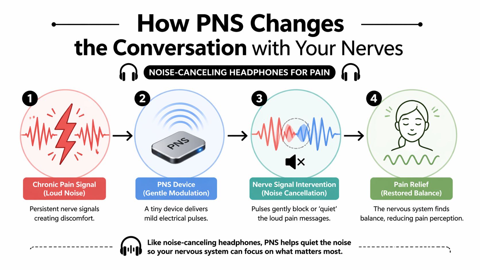 A four-step infographic illustrating how Peripheral Nerve Stimulation (PNS) uses electrical pulses to reduce chronic pain.
