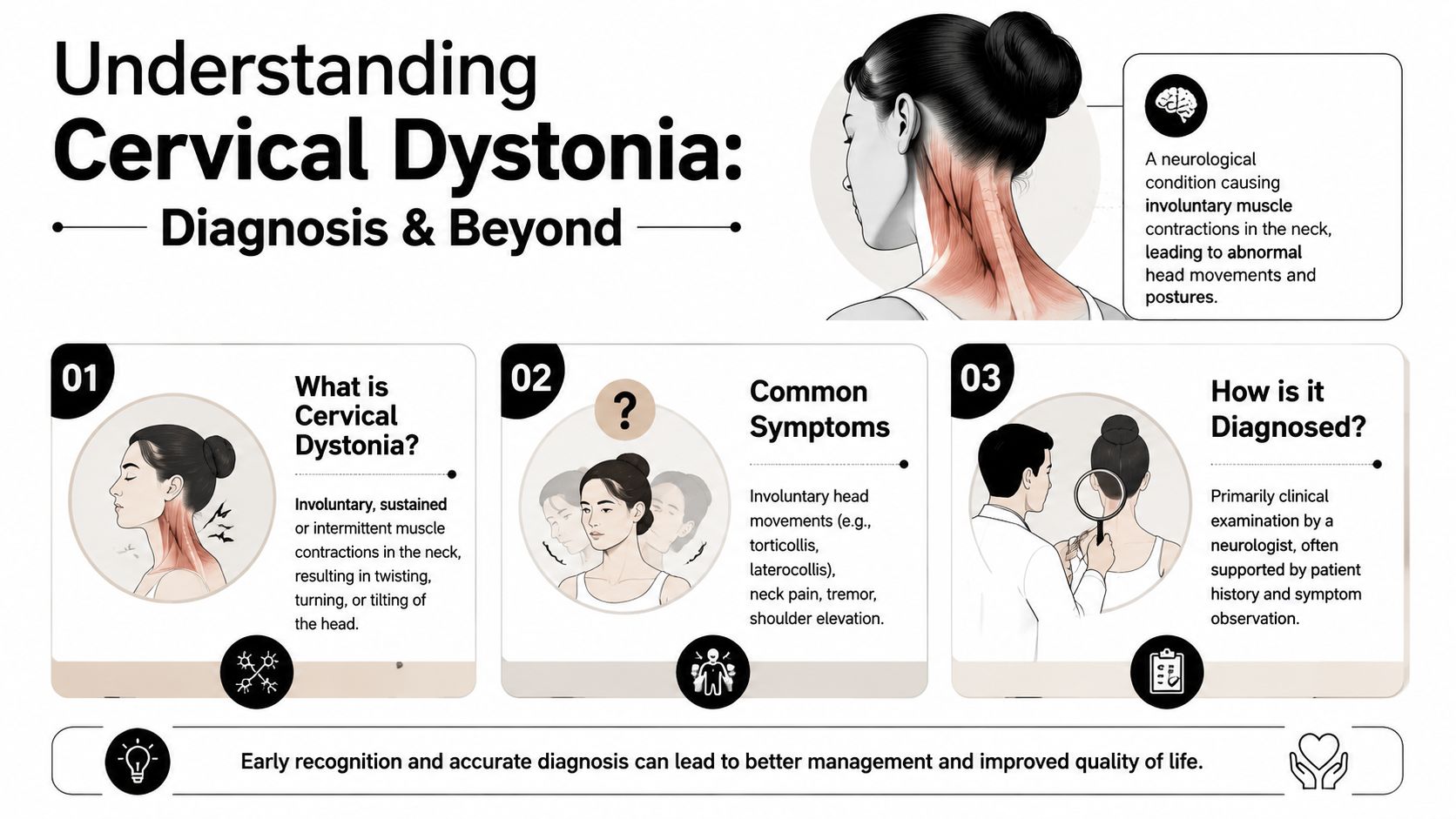 An infographic titled Understanding Cervical Dystonia explains the symptoms, diagnosis, and nature of this neurological condition.
