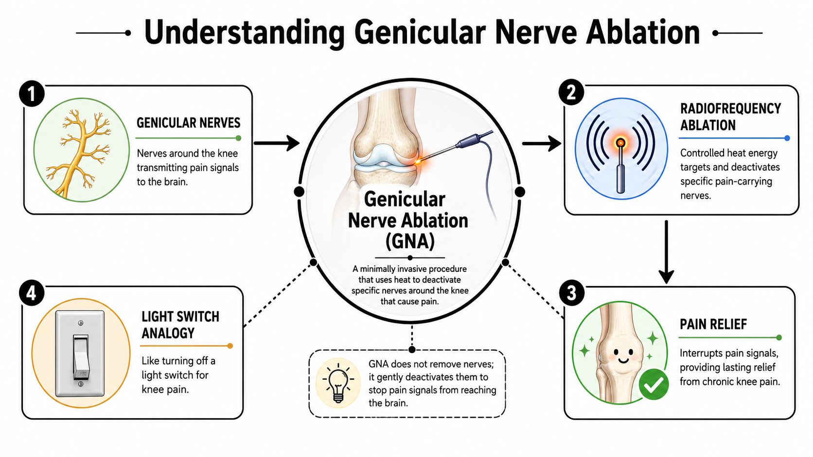 genicular nerve ablation medical diagram That's why many people start looking beyond temporary relief. If you're also comparing knee pain relief methods, it helps to understand where minimally invasive pain procedures fit. Some treatments aim to calm inflammation. Others support the joint mechanically. Genicular nerve ablation is different. It targets the pain signals traveling from the knee. Genicular Nerve Ablation: A Guide to Knee Pain Relief A diagram explaining the Genicular Nerve Ablation procedure for relieving chronic knee pain using radiofrequency heat.