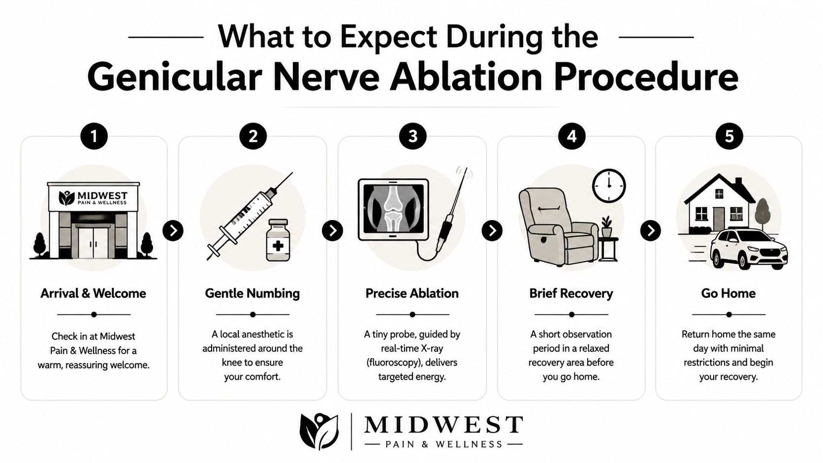 genicular nerve ablation procedure steps That's why many people start looking beyond temporary relief. If you're also comparing knee pain relief methods, it helps to understand where minimally invasive pain procedures fit. Some treatments aim to calm inflammation. Others support the joint mechanically. Genicular nerve ablation is different. It targets the pain signals traveling from the knee. Genicular Nerve Ablation: A Guide to Knee Pain Relief A five-step infographic illustrating the patient journey and process during a genicular nerve ablation procedure.
