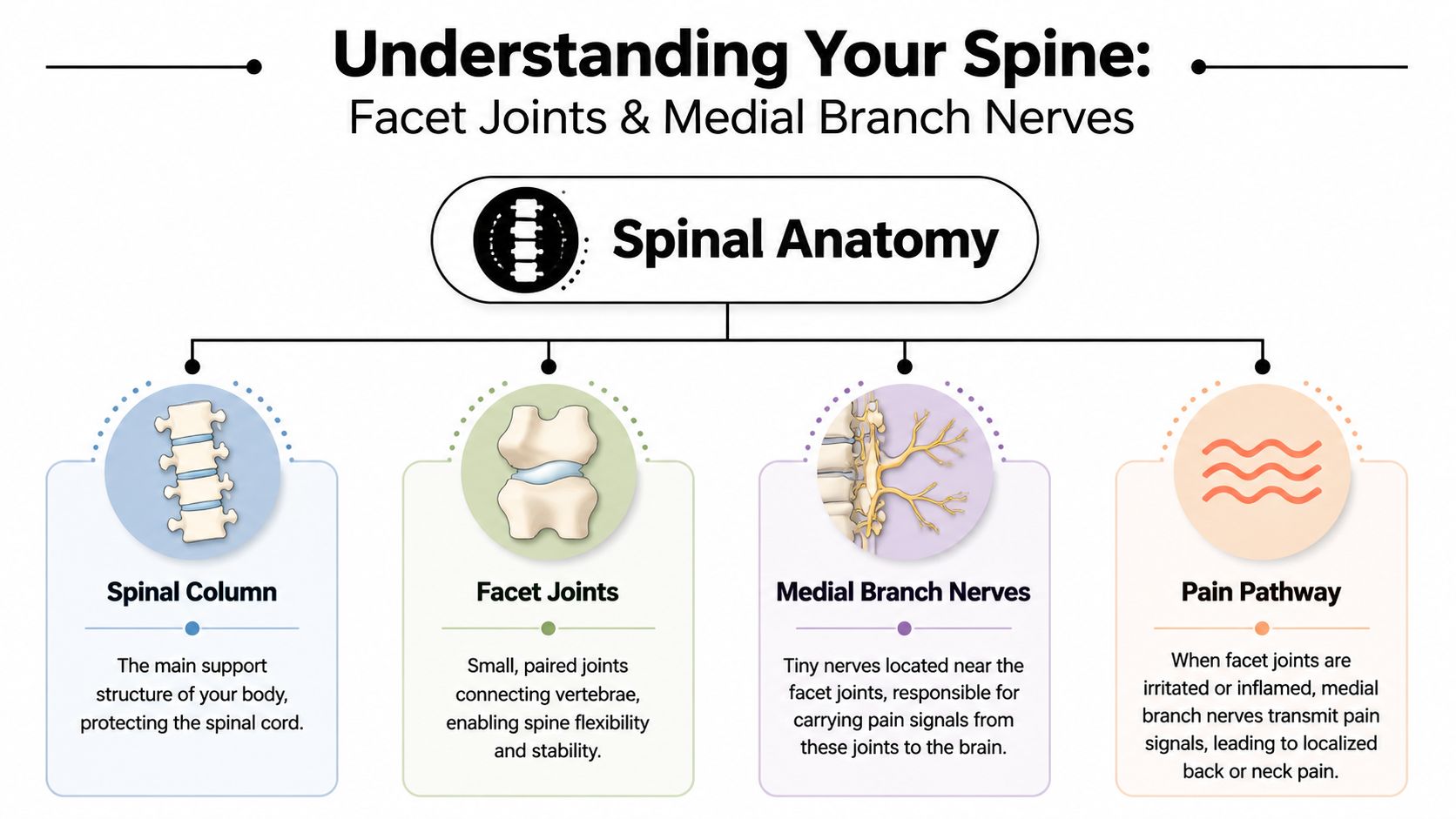 An infographic explaining spinal anatomy, specifically highlighting facet joints and the medial branch nerve pain pathway.