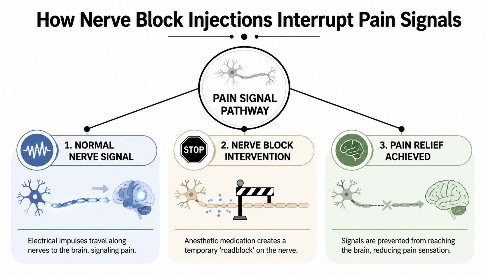A diagram illustrating how nerve block injections temporarily interrupt pain signals from reaching the brain.