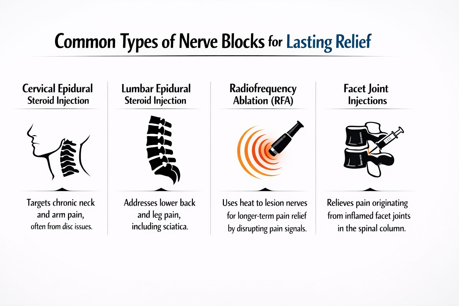 An infographic showing four common types of nerve block injections used for pain management in the spine.