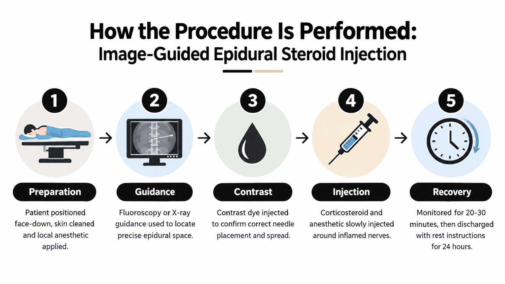 epidural steroid injection spinal stenosis procedure steps You've started avoiding the grocery store, leaning on a cart, or stopping after a short walk because your legs become painful, heavy, numb, or weak. Sitting may ease the symptoms, but standing again brings them back. An MRI may show lumbar spinal stenosis, and the next question is often whether an epidural steroid injection for spinal stenosis will reduce your pain or help you function a little better. Epidural Steroid Injection Spinal Stenosis: What to Expect A five-step infographic illustrating the medical procedure for an image-guided epidural steroid injection for pain relief.