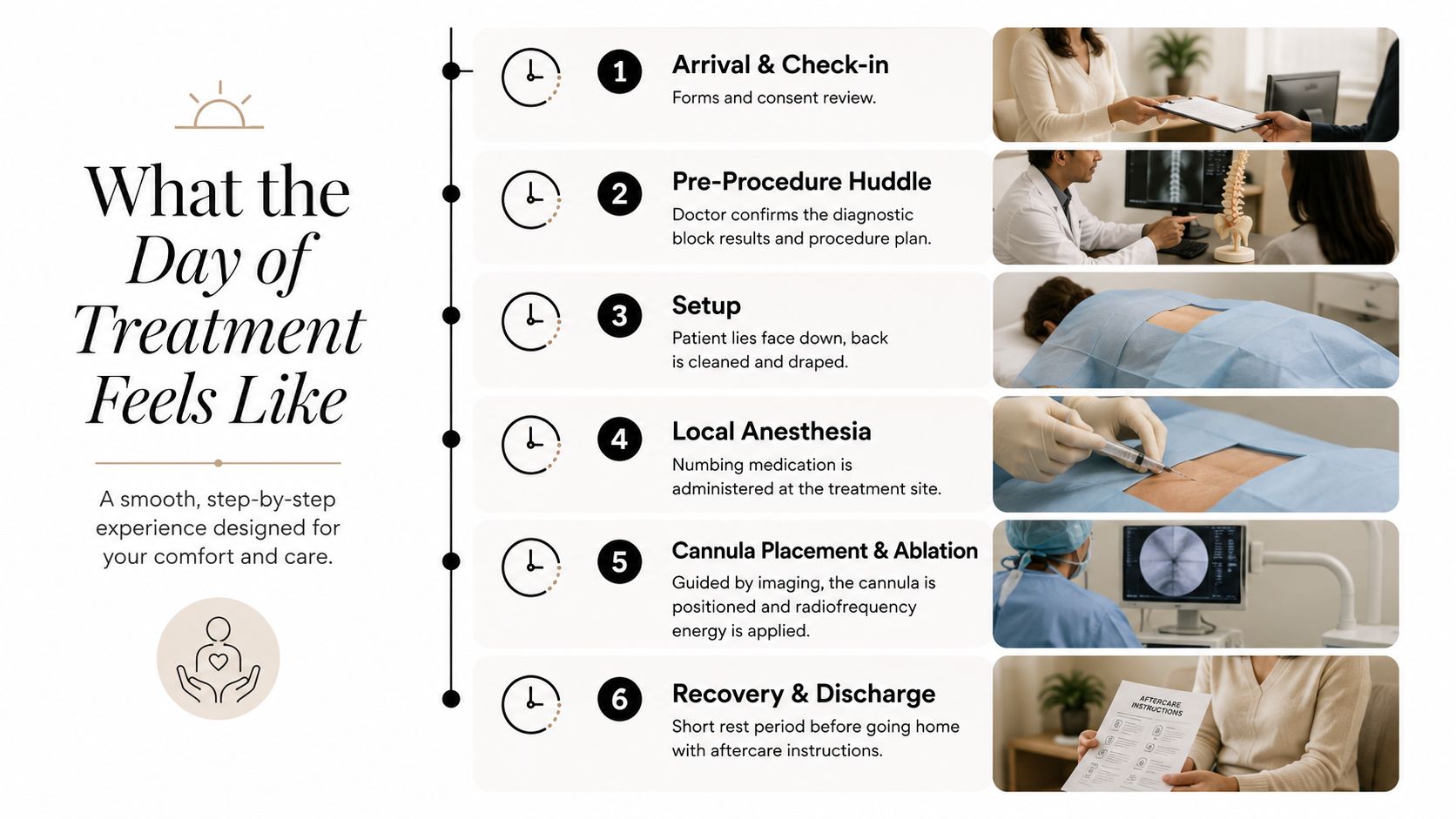 A six-step infographic illustrating the medical procedure process for a patient receiving radiofrequency ablation for back pain.