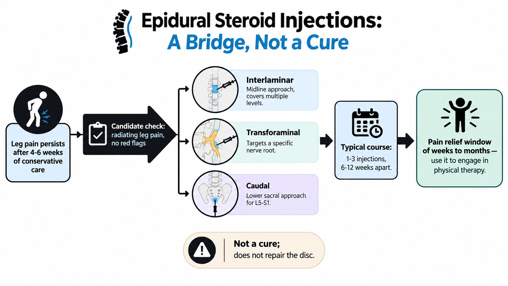 A diagram explaining the procedure, types, and expectations of epidural steroid injections for managing radiating leg pain.