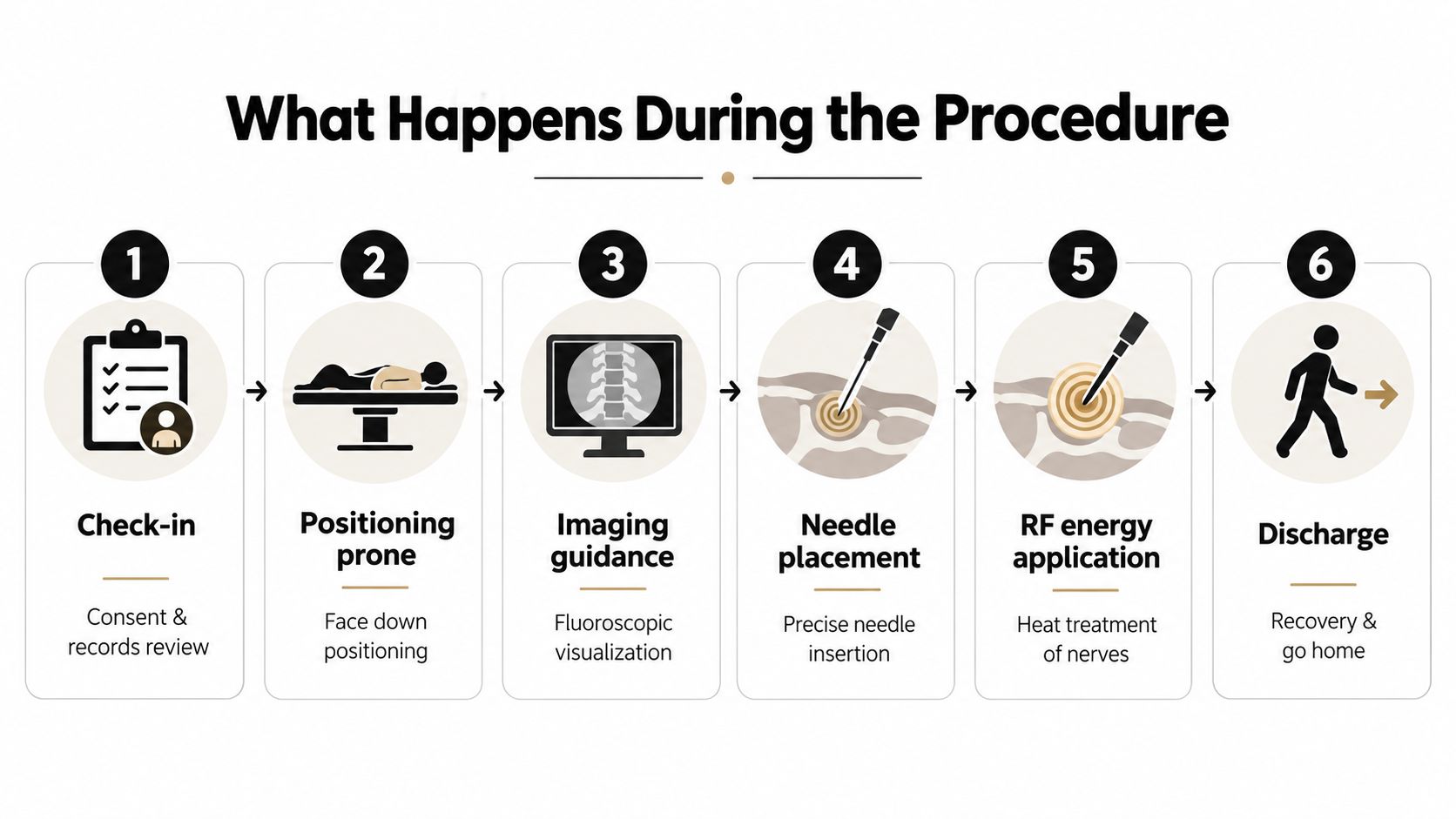 A step-by-step infographic illustrating the six-part process of a radiofrequency ablation SI joint procedure.